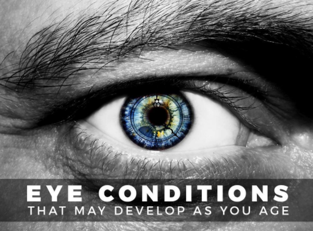 Eye Conditions That May Develop as You Age