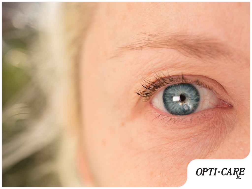 5 Common Causes of Myokymia and Treatment Methods - Opti-Care
